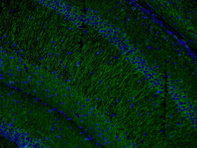 MAP2 Antibody in Immunohistochemistry (PFA fixed) (IHC (PFA))