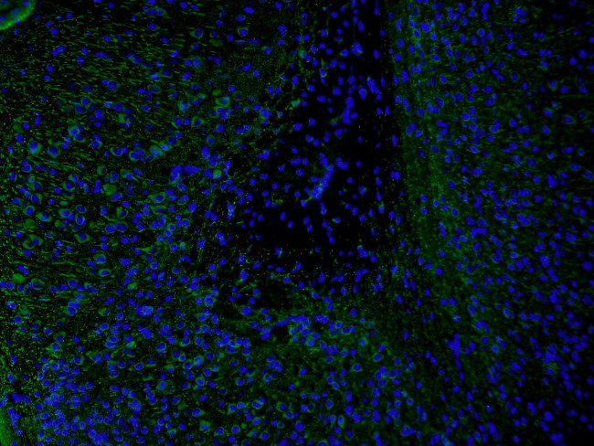 MAP2 Antibody in Immunohistochemistry (PFA fixed) (IHC (PFA))