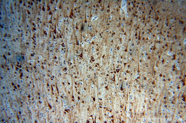 MAP2 Antibody in Immunohistochemistry (Paraffin) (IHC (P))