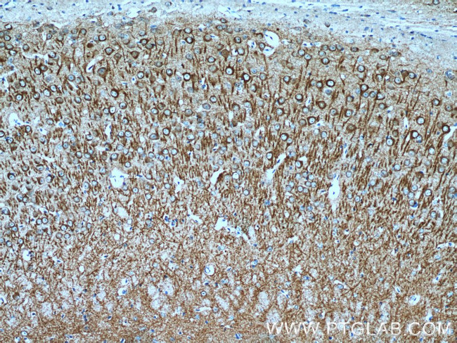 MAP2 Antibody in Immunohistochemistry (Paraffin) (IHC (P))