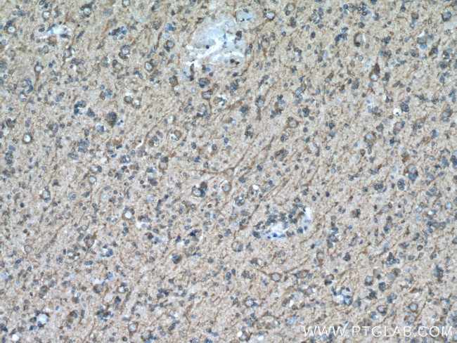 MAP2 Antibody in Immunohistochemistry (Paraffin) (IHC (P))