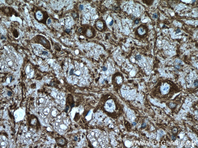 MAP2 Antibody in Immunohistochemistry (Paraffin) (IHC (P))