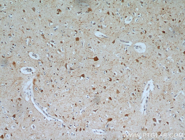 MAP2 Antibody in Immunohistochemistry (Paraffin) (IHC (P))