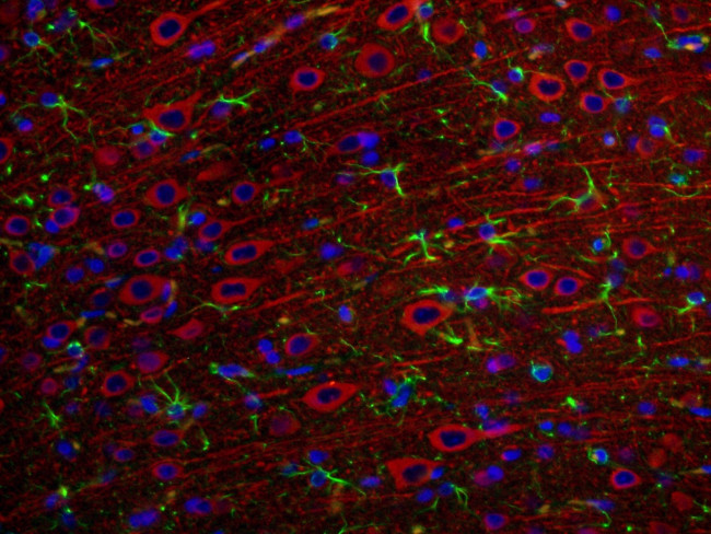 MAP2 Antibody in Immunohistochemistry (PFA fixed) (IHC (PFA))