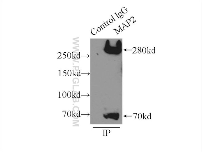 MAP2 Antibody in Immunoprecipitation (IP)