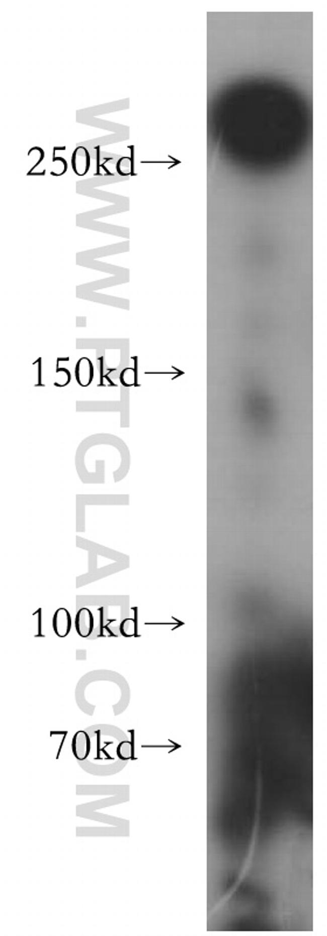 MAP2 Antibody in Western Blot (WB)