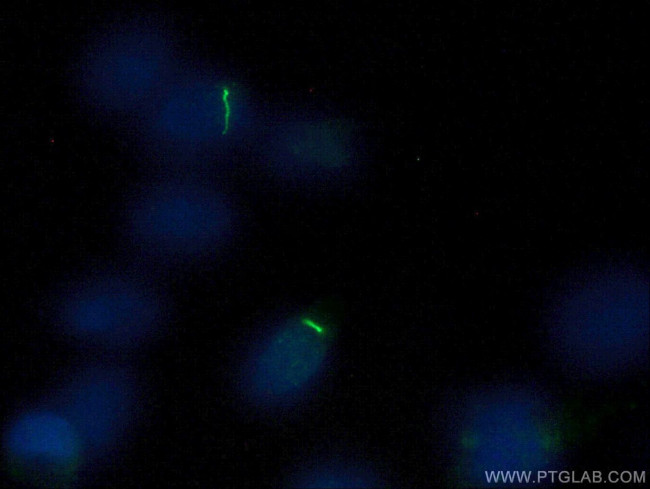 ARL13B Antibody in Immunocytochemistry (ICC/IF)