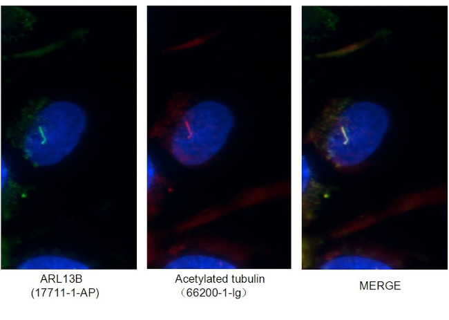 ARL13B Antibody in Immunocytochemistry (ICC/IF)