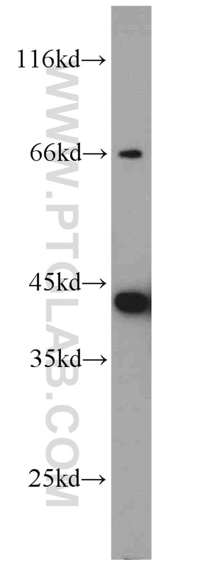 ARL13B Antibody in Western Blot (WB)