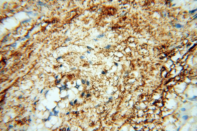 P2RY1 Antibody in Immunohistochemistry (Paraffin) (IHC (P))