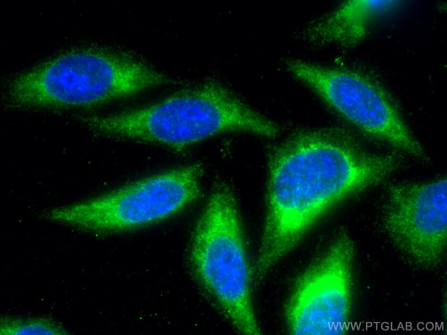 iNOS Antibody in Immunocytochemistry (ICC/IF)