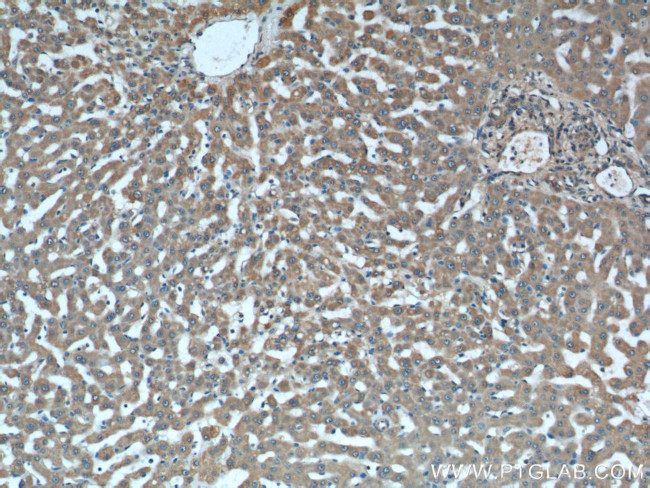 iNOS Antibody in Immunohistochemistry (Paraffin) (IHC (P))