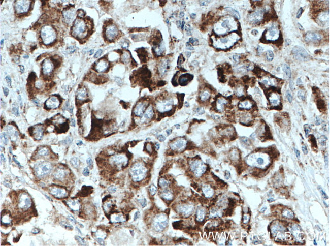 VEGF Antibody in Immunohistochemistry (Paraffin) (IHC (P))