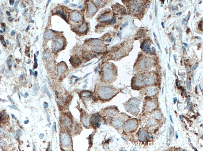 VEGF Antibody in Immunohistochemistry (Paraffin) (IHC (P))