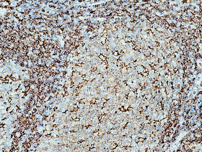 NOX2 Antibody in Immunohistochemistry (Paraffin) (IHC (P))