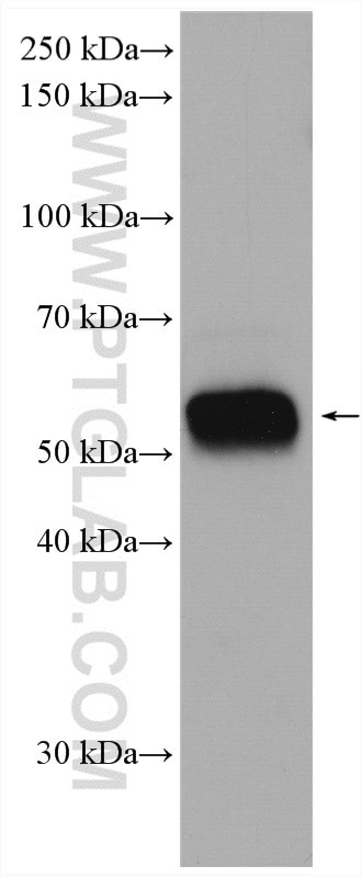 NOX2 Antibody in Western Blot (WB)