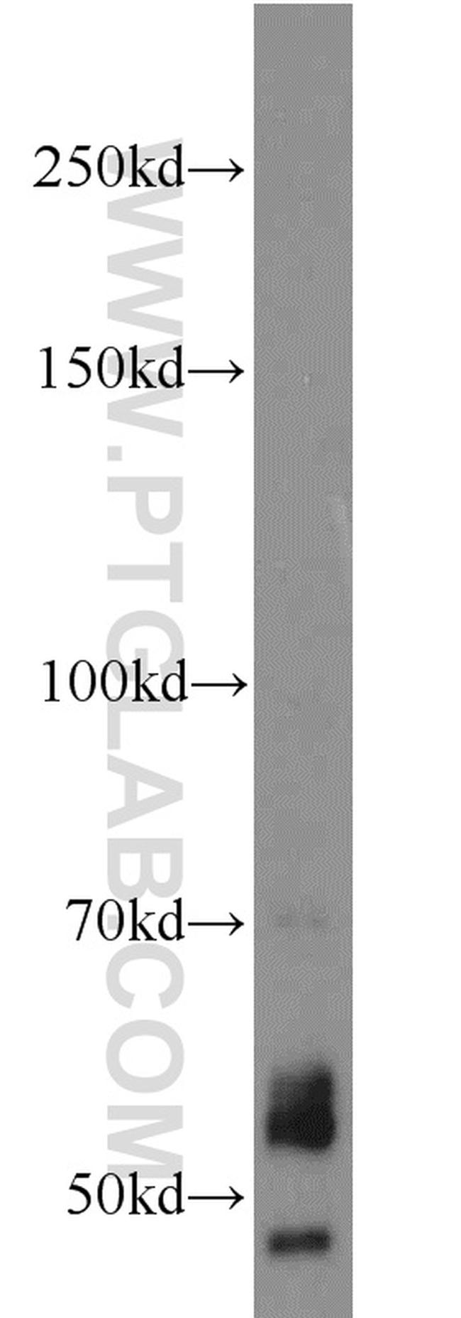 NOX2 Antibody in Western Blot (WB)