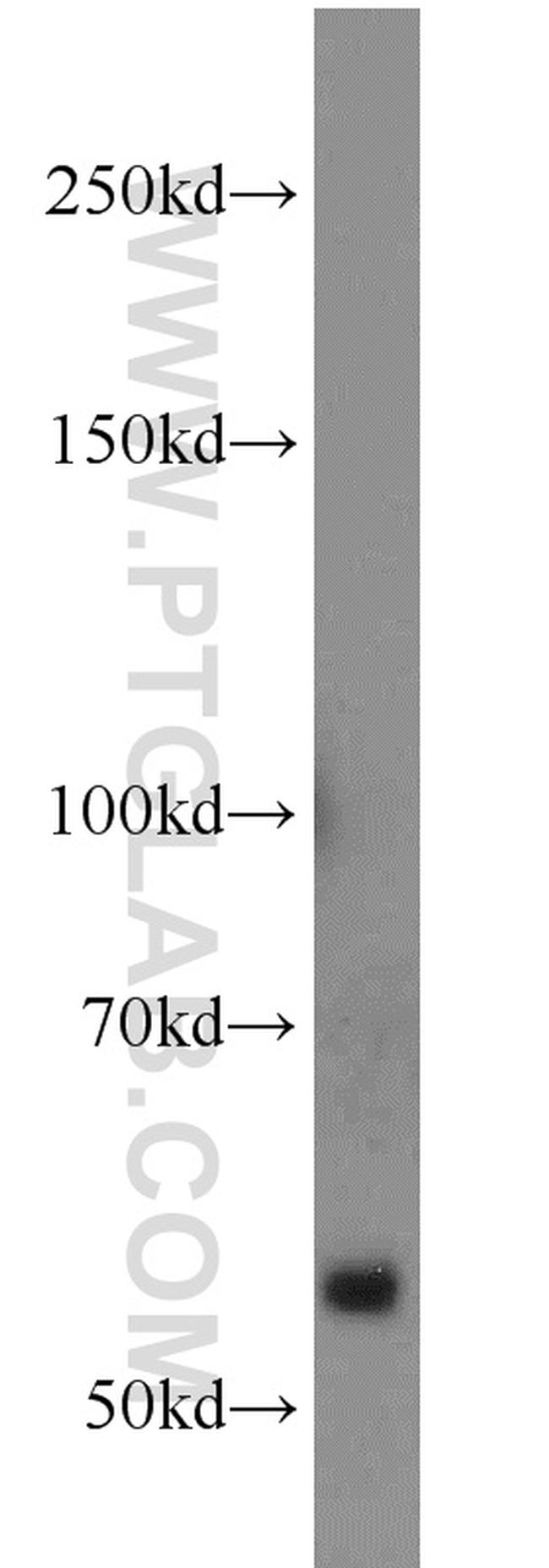 NOX2 Antibody in Western Blot (WB)