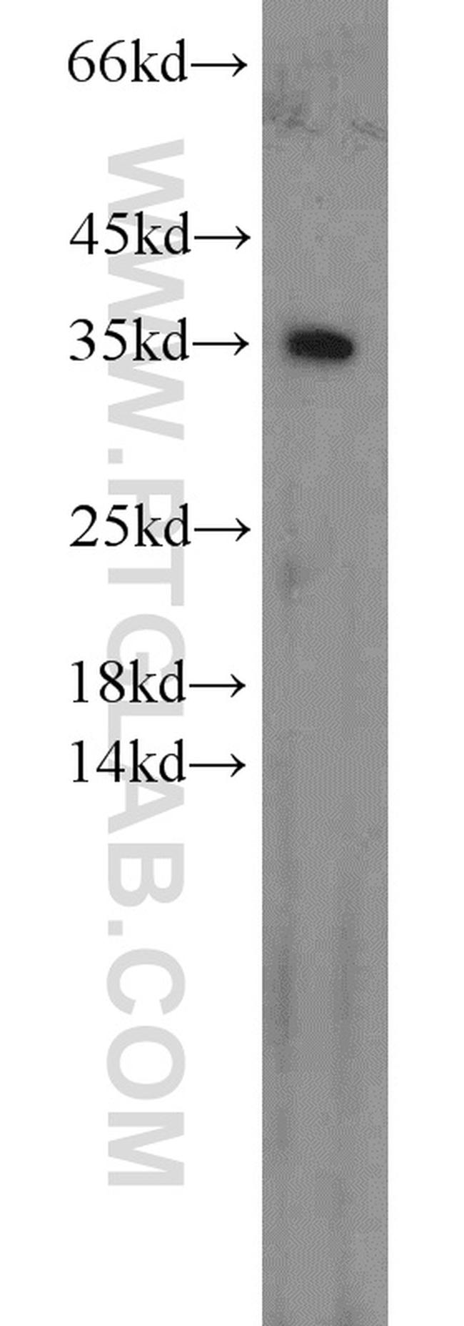 CDK1 Antibody in Western Blot (WB)