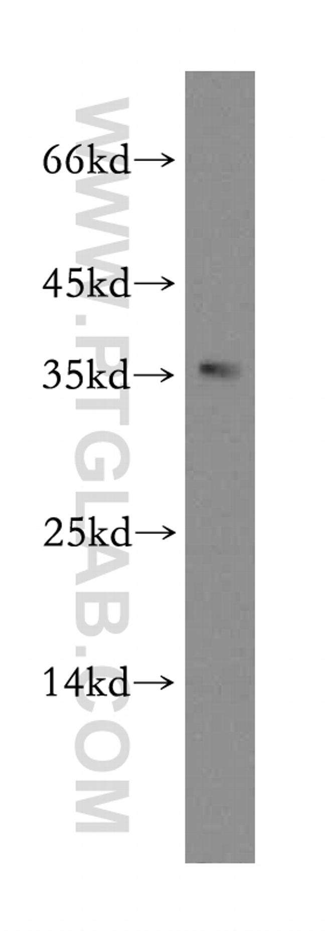 CDK1 Antibody in Western Blot (WB)