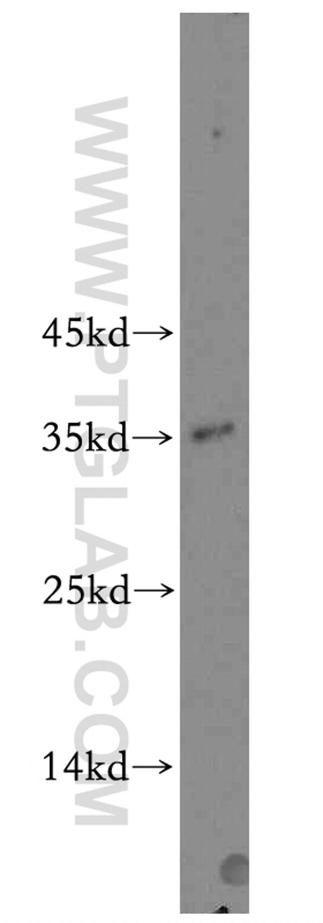 CDK1 Antibody in Western Blot (WB)