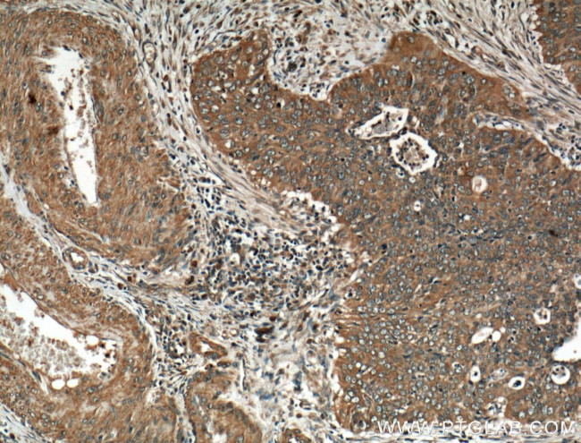 CDK1 Antibody in Immunohistochemistry (Paraffin) (IHC (P))