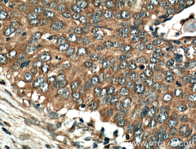 CDK1 Antibody in Immunohistochemistry (Paraffin) (IHC (P))