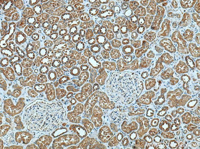 NLRP3 Antibody in Immunohistochemistry (Paraffin) (IHC (P))