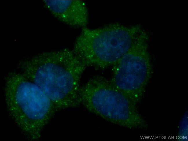 GSDMD Antibody in Immunocytochemistry (ICC/IF)