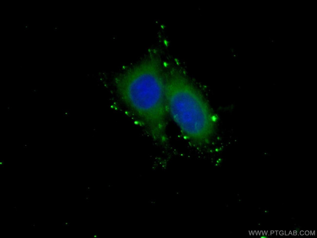 GSDMD Antibody in Immunocytochemistry (ICC/IF)