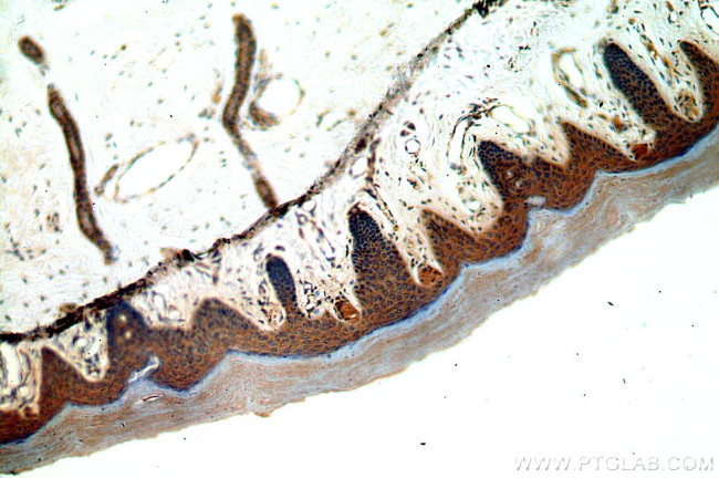 GSDMD Antibody in Immunohistochemistry (Paraffin) (IHC (P))