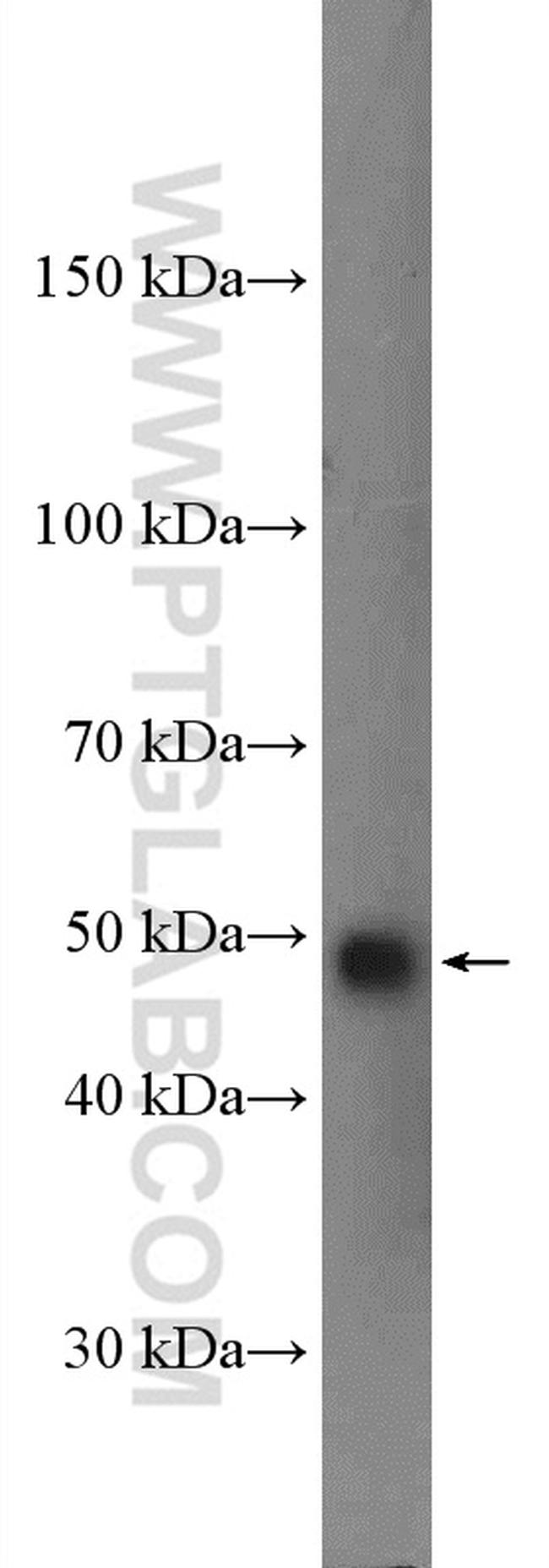 GSDMD Antibody in Western Blot (WB)