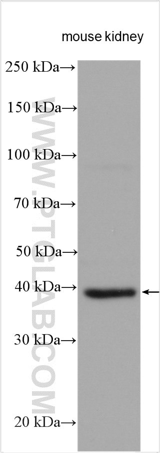 AIFM2 Antibody in Western Blot (WB)