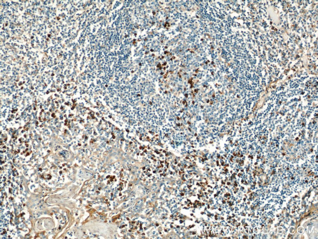 IL-6 Antibody in Immunohistochemistry (Paraffin) (IHC (P))