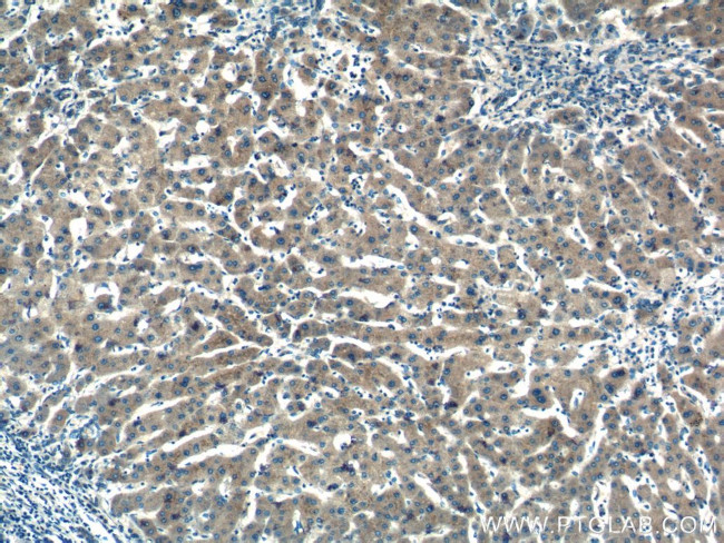 IL-6 Antibody in Immunohistochemistry (Paraffin) (IHC (P))