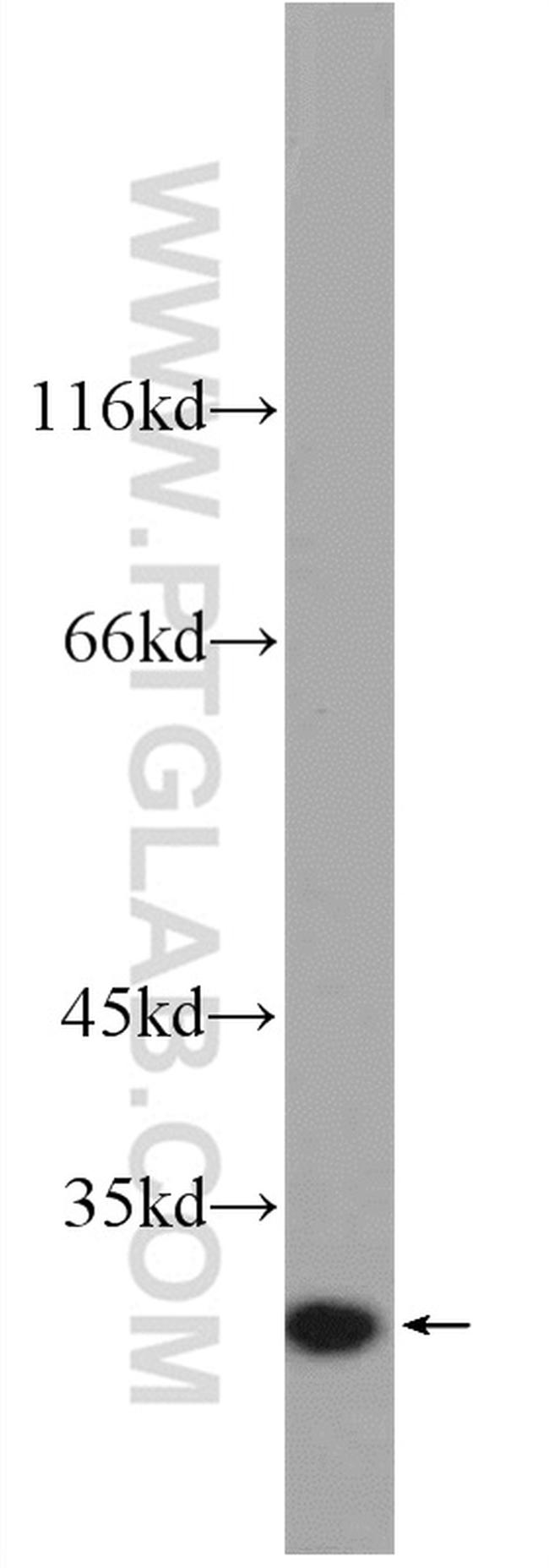 IL-6 Antibody in Western Blot (WB)