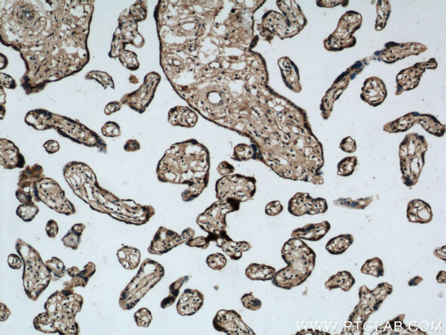 PPAR Gamma Antibody in Immunohistochemistry (Paraffin) (IHC (P))