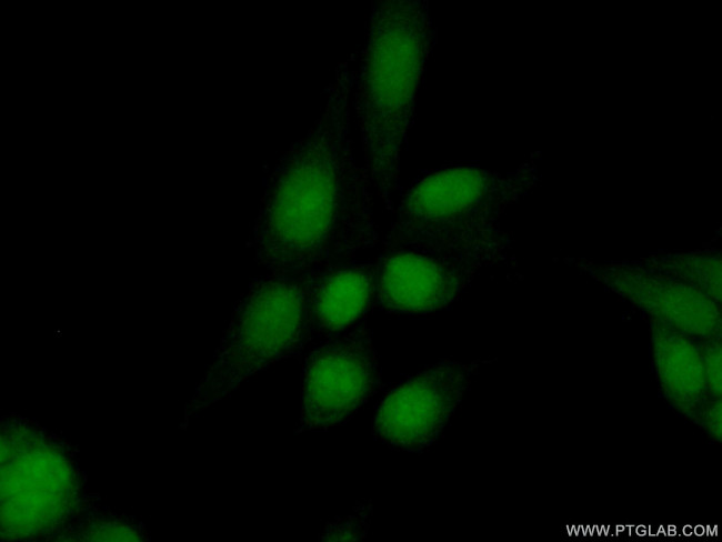 BRD2 Antibody in Immunocytochemistry (ICC/IF)