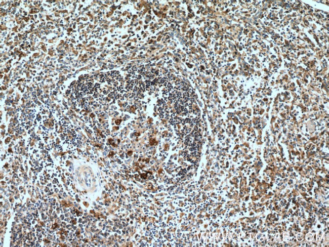 Caspase 1/p20/p10 Antibody in Immunohistochemistry (Paraffin) (IHC (P))