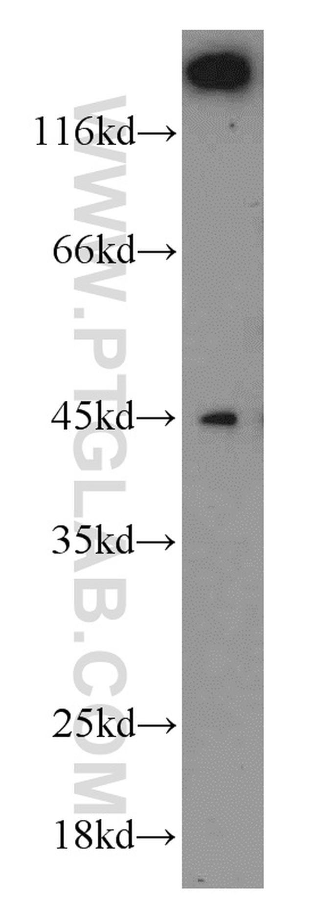 Caspase 1/p20/p10 Antibody in Western Blot (WB)