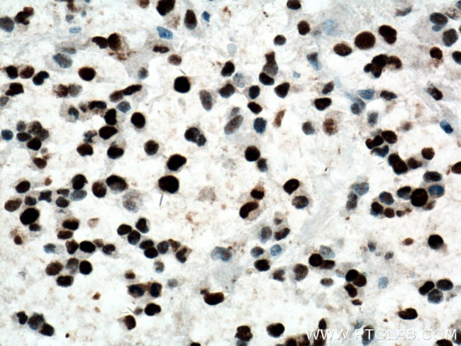 PCNA Antibody in Immunohistochemistry (Paraffin) (IHC (P))