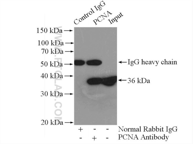 PCNA Antibody in Immunoprecipitation (IP)