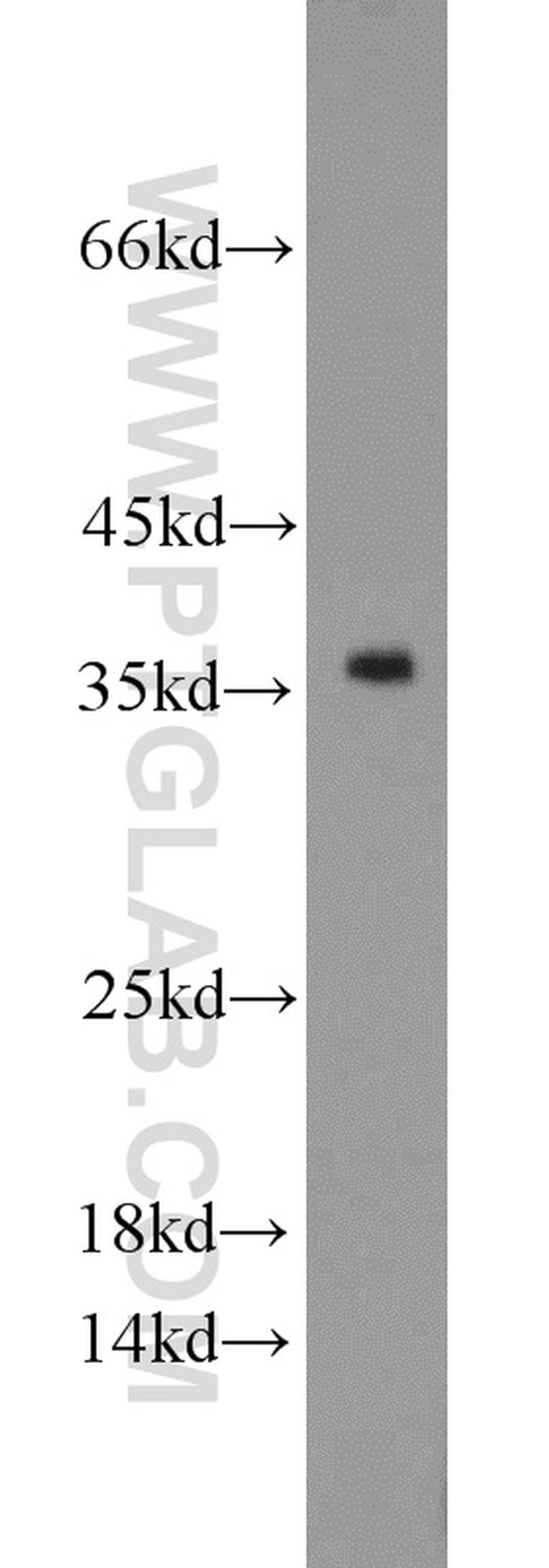 PCNA Antibody in Western Blot (WB)