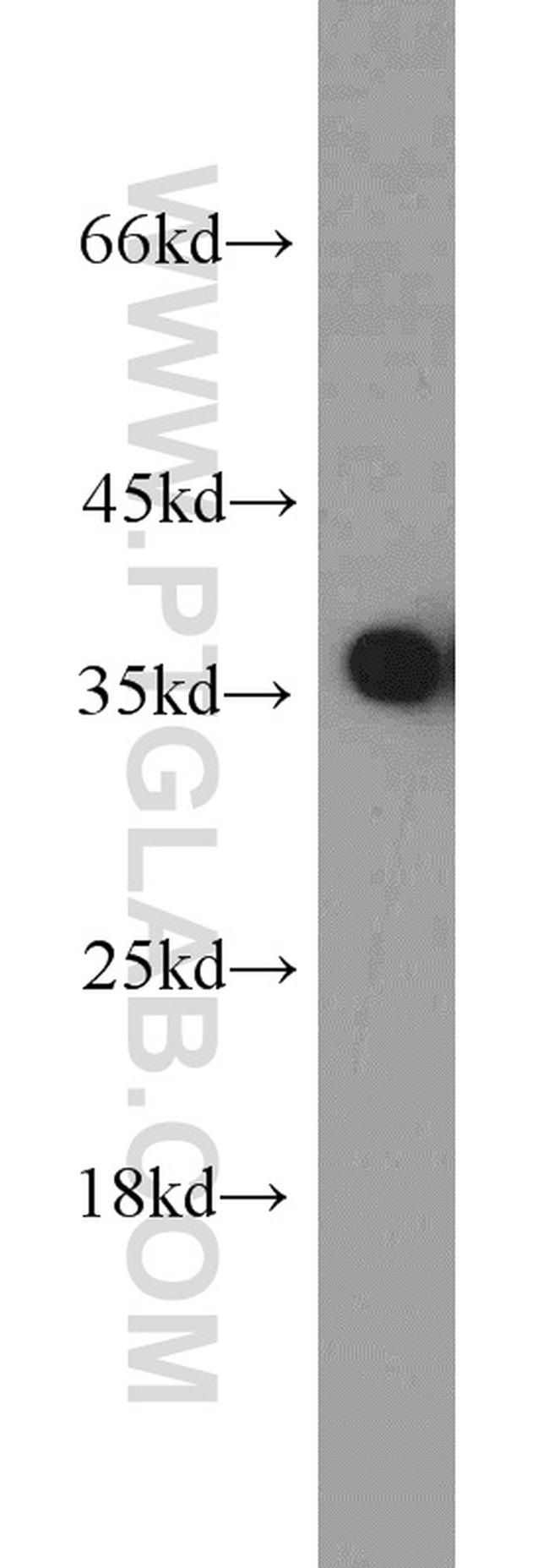 PCNA Antibody in Western Blot (WB)