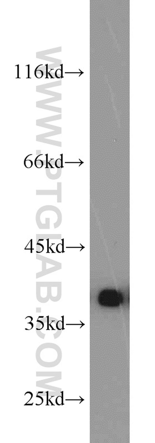 PCNA Antibody in Western Blot (WB)