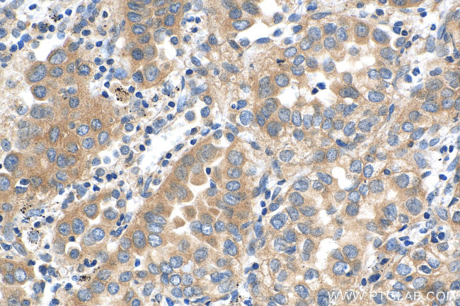 c-Met (Cytoplasmic) Antibody in Immunohistochemistry (Paraffin) (IHC (P))