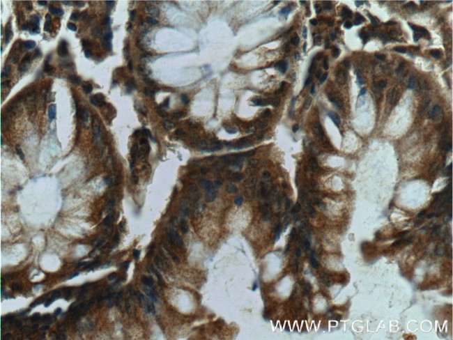 c-Met (Cytoplasmic) Antibody in Immunohistochemistry (Paraffin) (IHC (P))