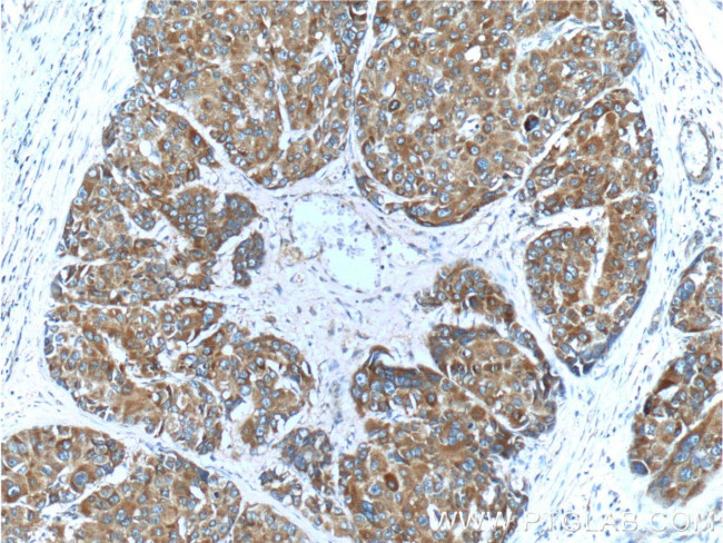 c-Met (Cytoplasmic) Antibody in Immunohistochemistry (Paraffin) (IHC (P))