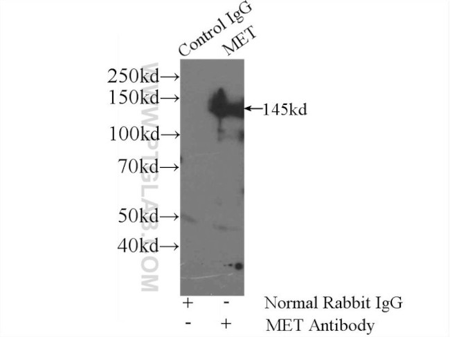 c-Met (Cytoplasmic) Antibody in Immunoprecipitation (IP)