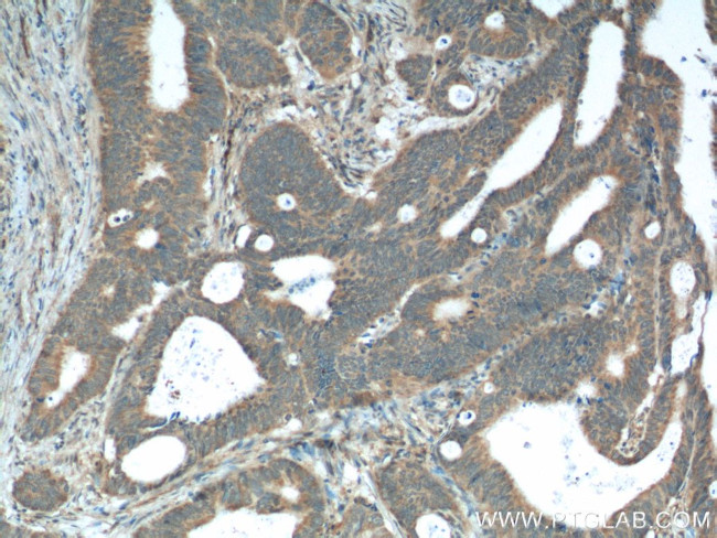 XBP1 Antibody in Immunohistochemistry (Paraffin) (IHC (P))